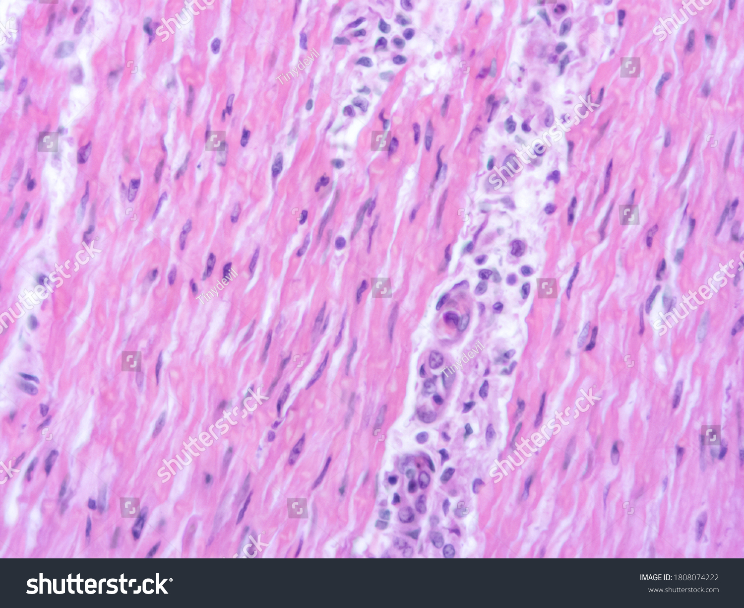 Picture Histology Human Tissue Microscope Laboratory Stock Photo ...