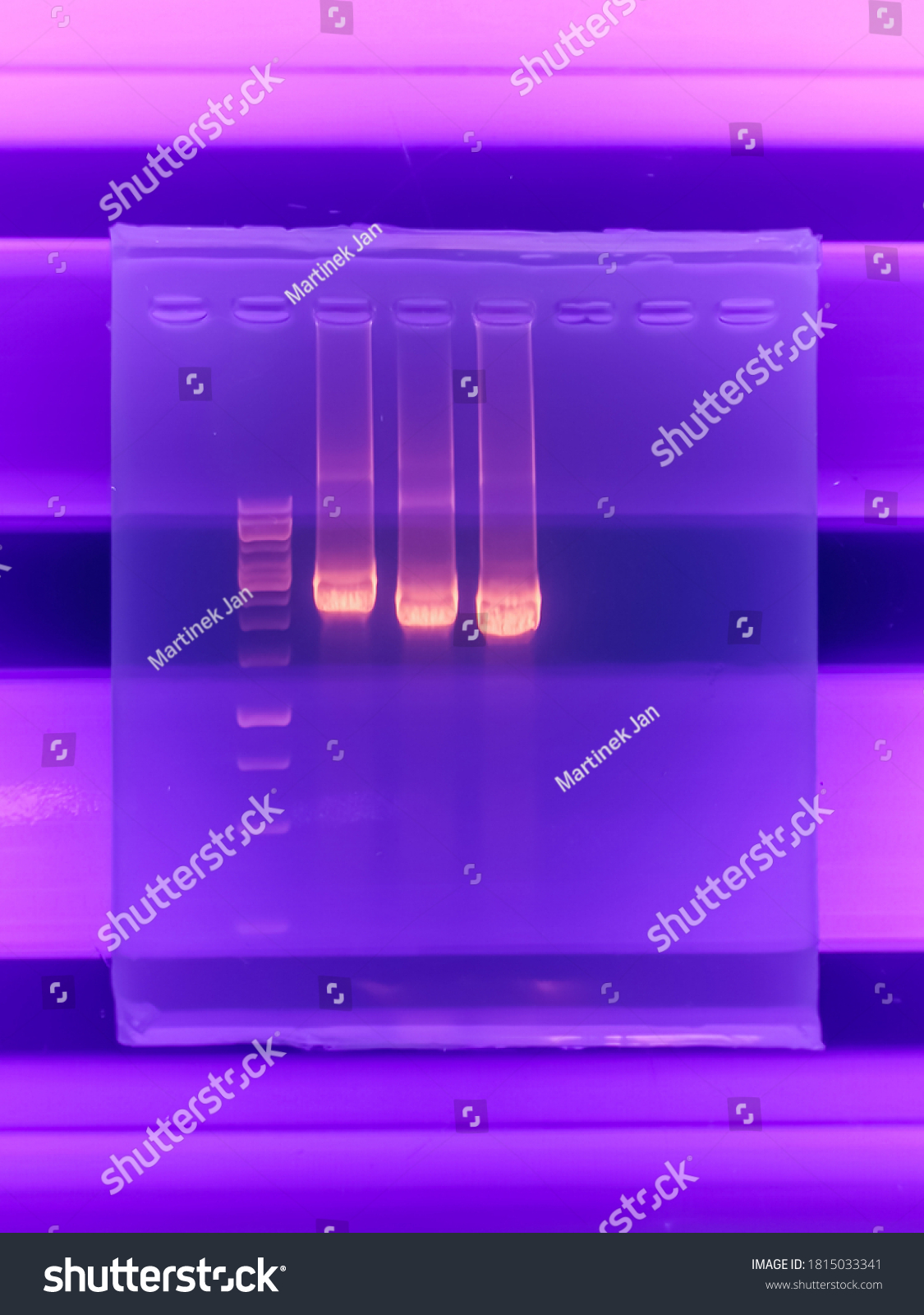 Ilustrasi Stok Result Agarose Gel Electrophoresis Pcr Products 1815033341 Shutterstock 9015