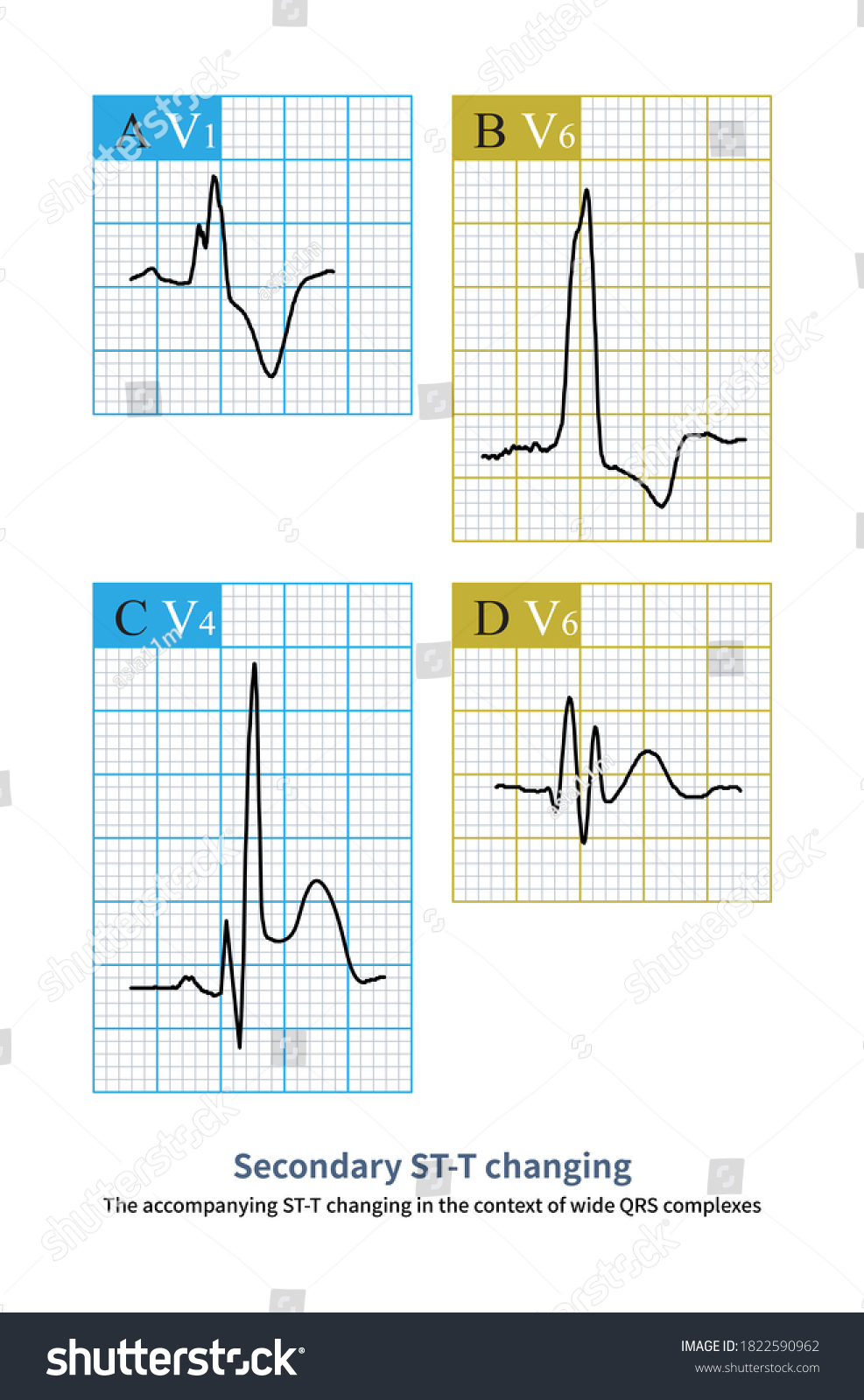 100 Wide qrs Images, Stock Photos & Vectors | Shutterstock