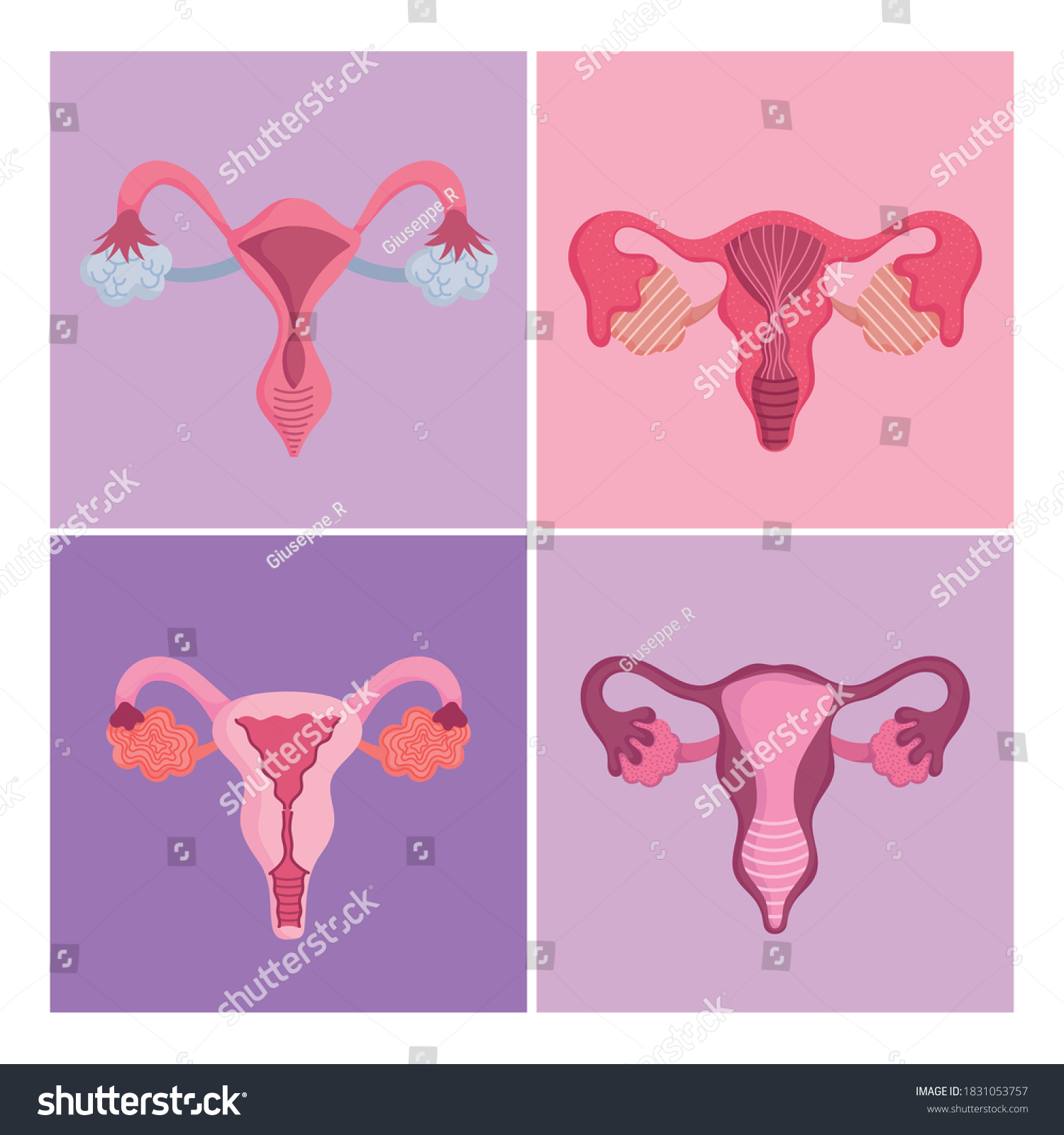 Vektor Stok Female Human Reproductive System Set Different Tanpa Royalti 1831053757 Shutterstock 6570