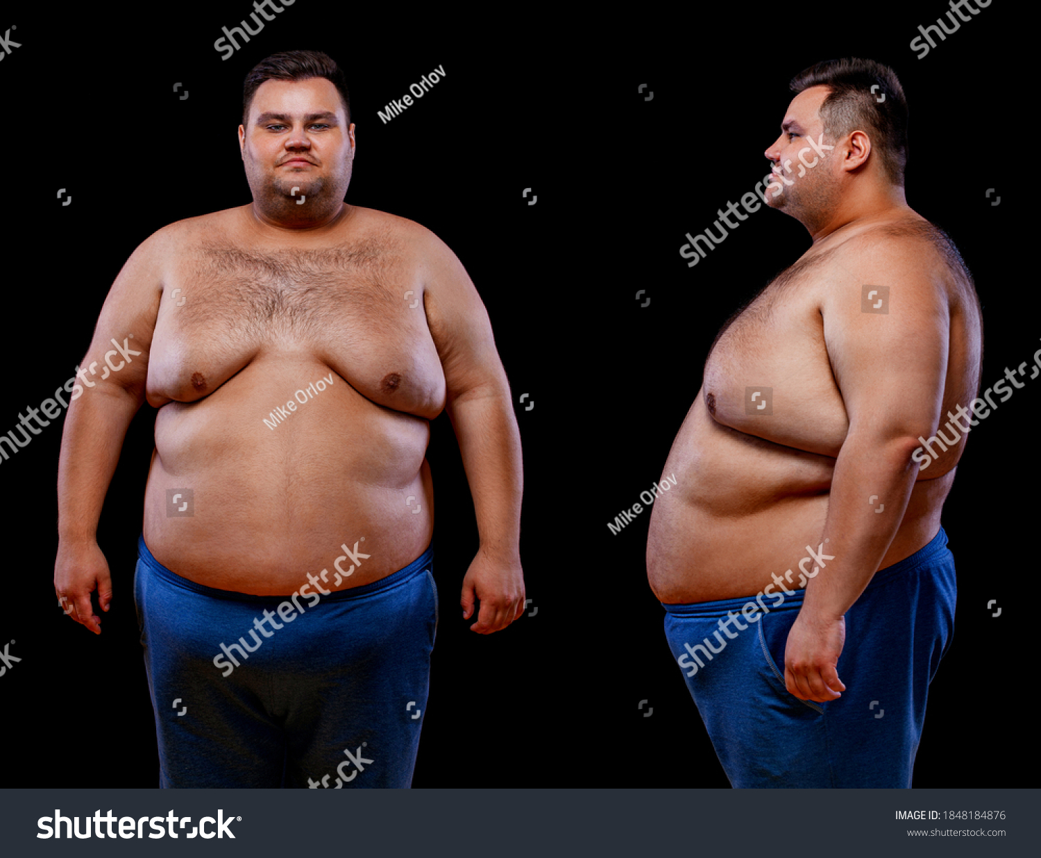 Two Views Young Shirtless Fat Man Stok Fotoğrafı 1848184876 Shutterstock.