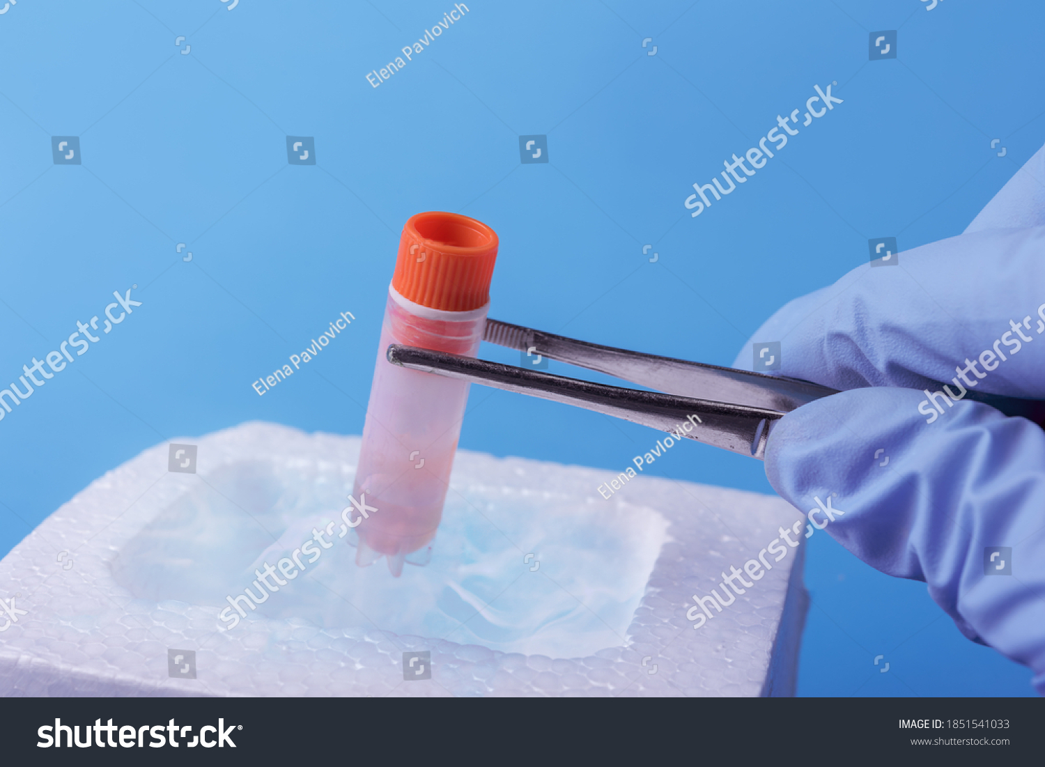 Cryopreservation Of Sample In Laboratory Scientist Hold Test Tube A