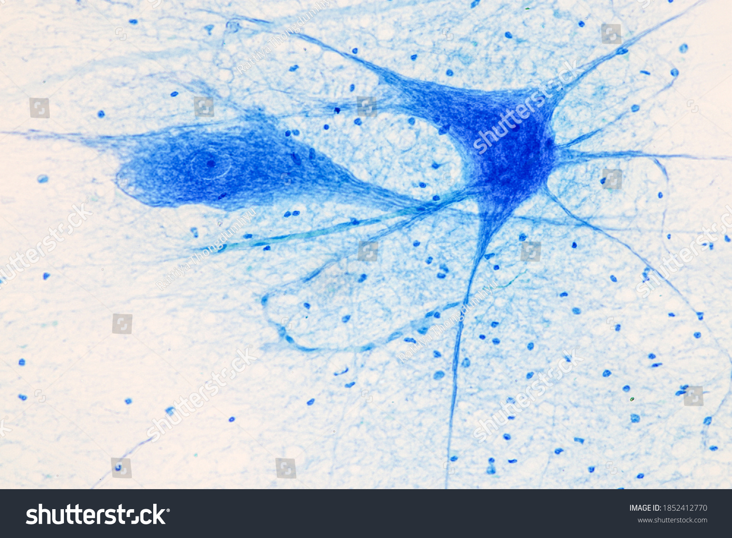 Motor Neuron Under Microscope Lab Stock Photo 1852412770 | Shutterstock