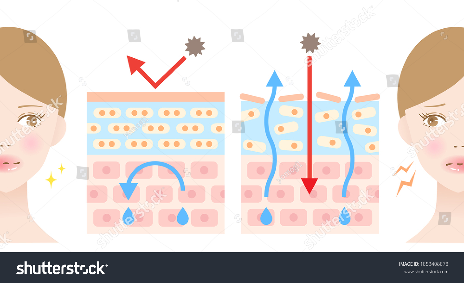 164 Damaged Skin Barrier Images, Stock Photos & Vectors | Shutterstock