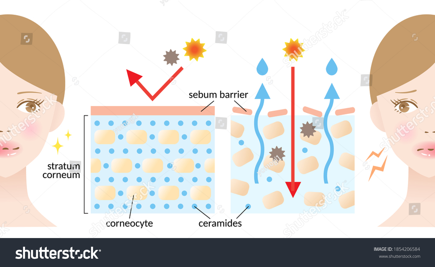 Dry Healthy Skin Layer Woman Illustration Stock Vector (Royalty Free ...