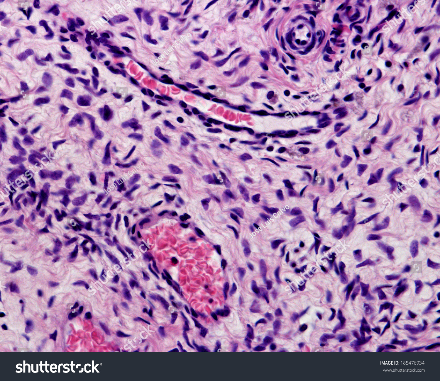 Small Blood Vessels Ovarian Stroma Seen Stock Photo 185476934 