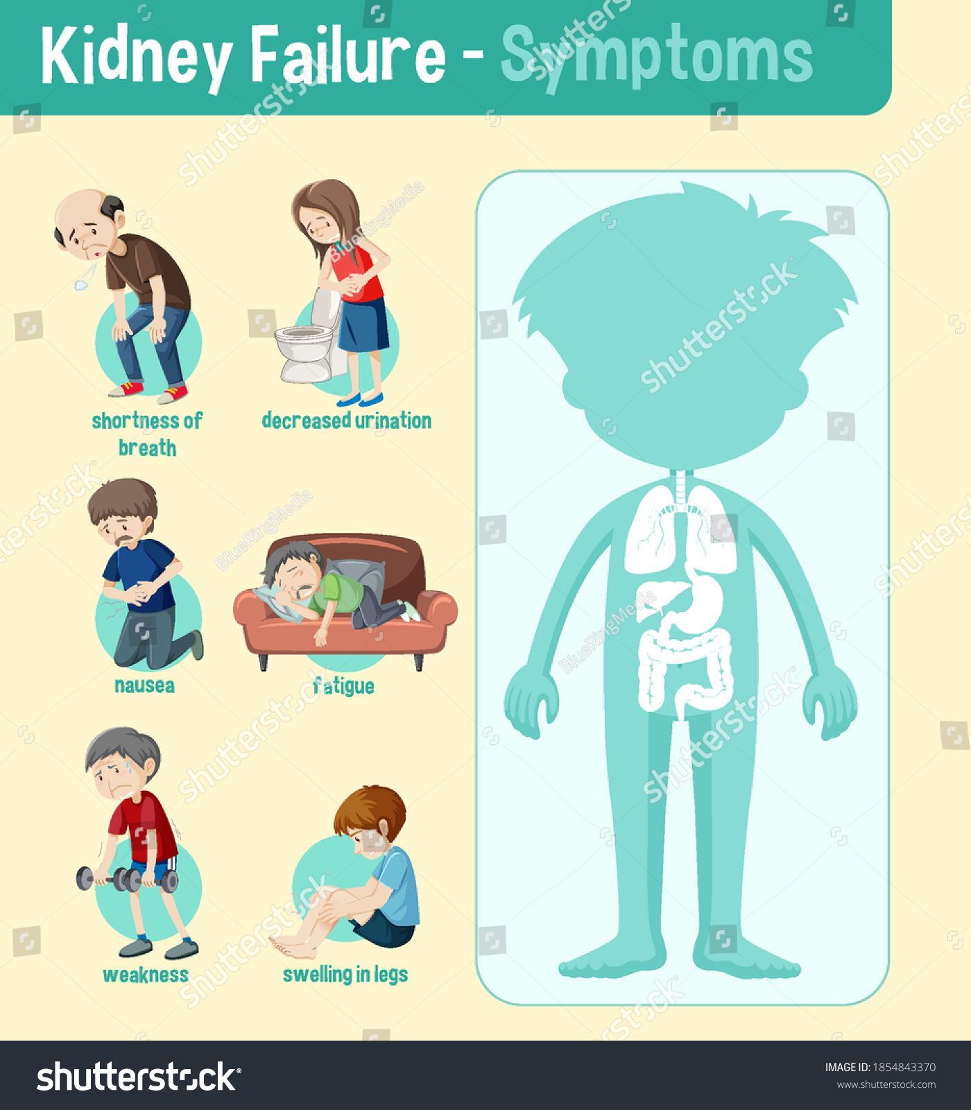 Kidney Failure Symptoms Information Infographic Illustration Stock ...