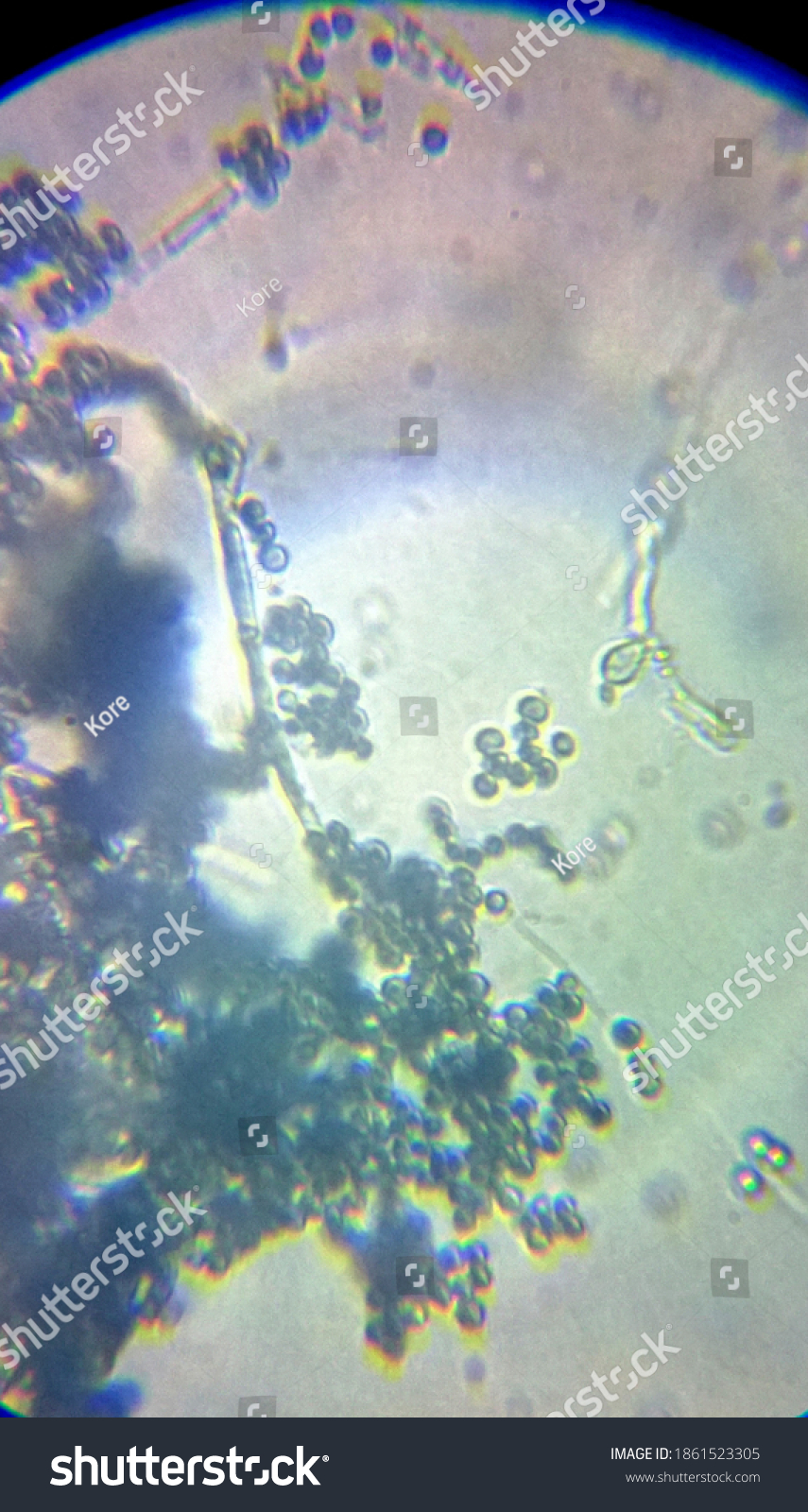 Penicillium Genus Mold Under Microscope Stock Photo 1861523305 ...