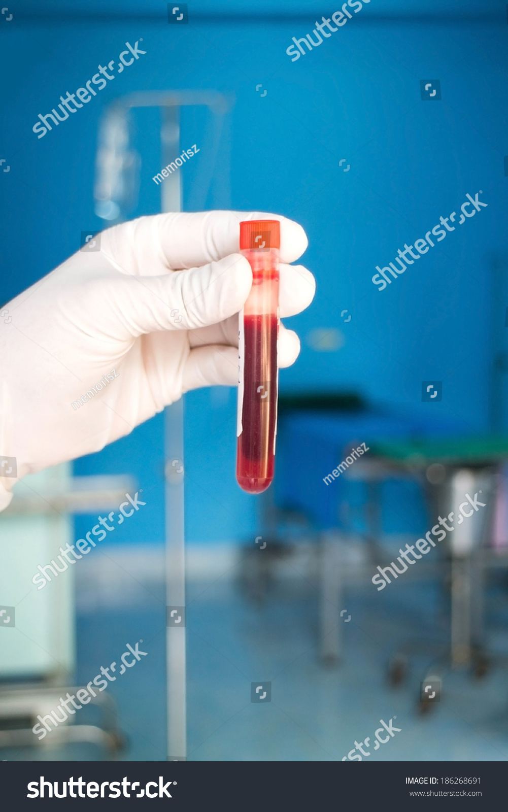 blood-test-pregnant-women-stock-photo-186268691-shutterstock