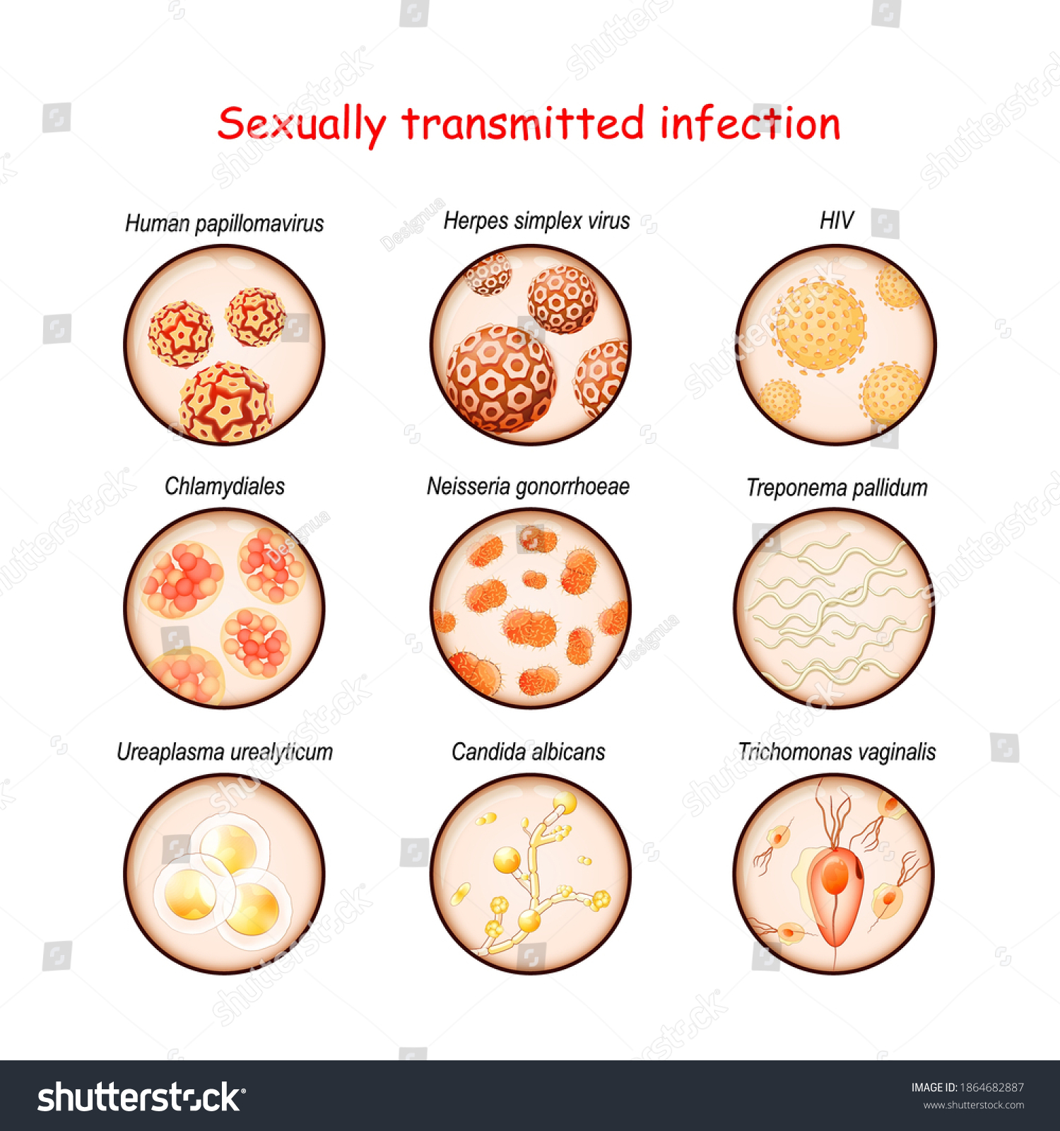 Sexually Transmitted Infection Closeup Causative Agents Stock Vector Royalty Free 1864682887 5414