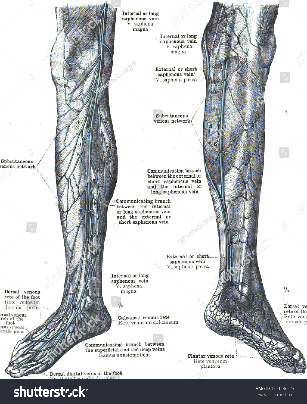 Анатомия варикоза нижних конечностей