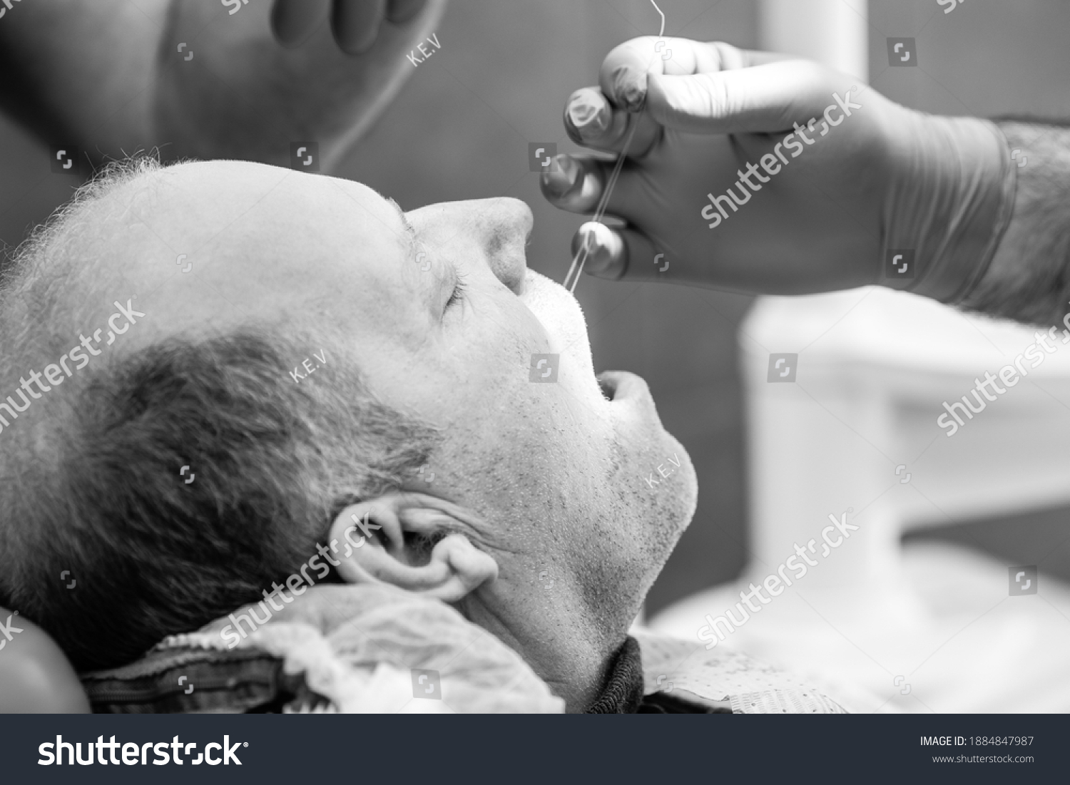 Dentist Doctor Sutures After Tooth Extraction Stock Photo 1884847987 ...