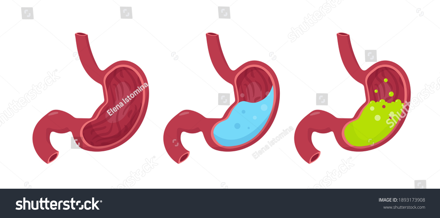 Human Stomach Set Empty Stomach Stomach Stock Vector (Royalty Free ...