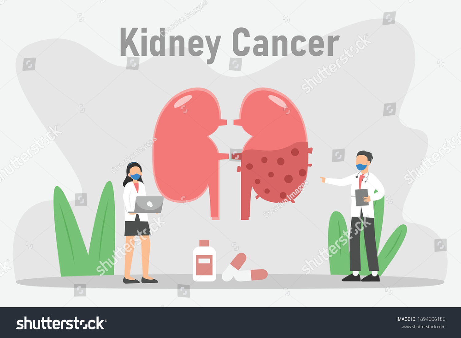 Kidney Cancer 2d Flat Vector Concept Stock Vector Royalty Free Kidney Cancer 2d Flat Vector Concept Stock Vector Royalty Free