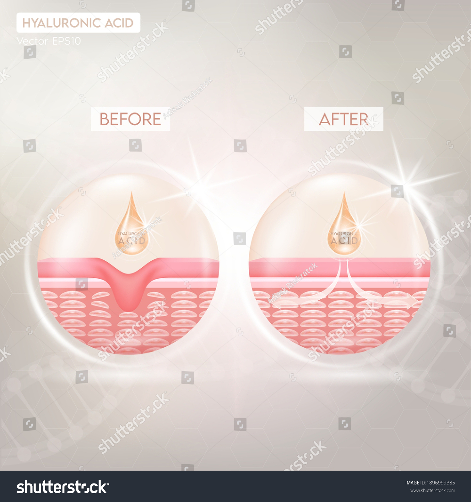 Process Getting Skin Younger Help Hyaluronic Stock Vector (Royalty Free ...