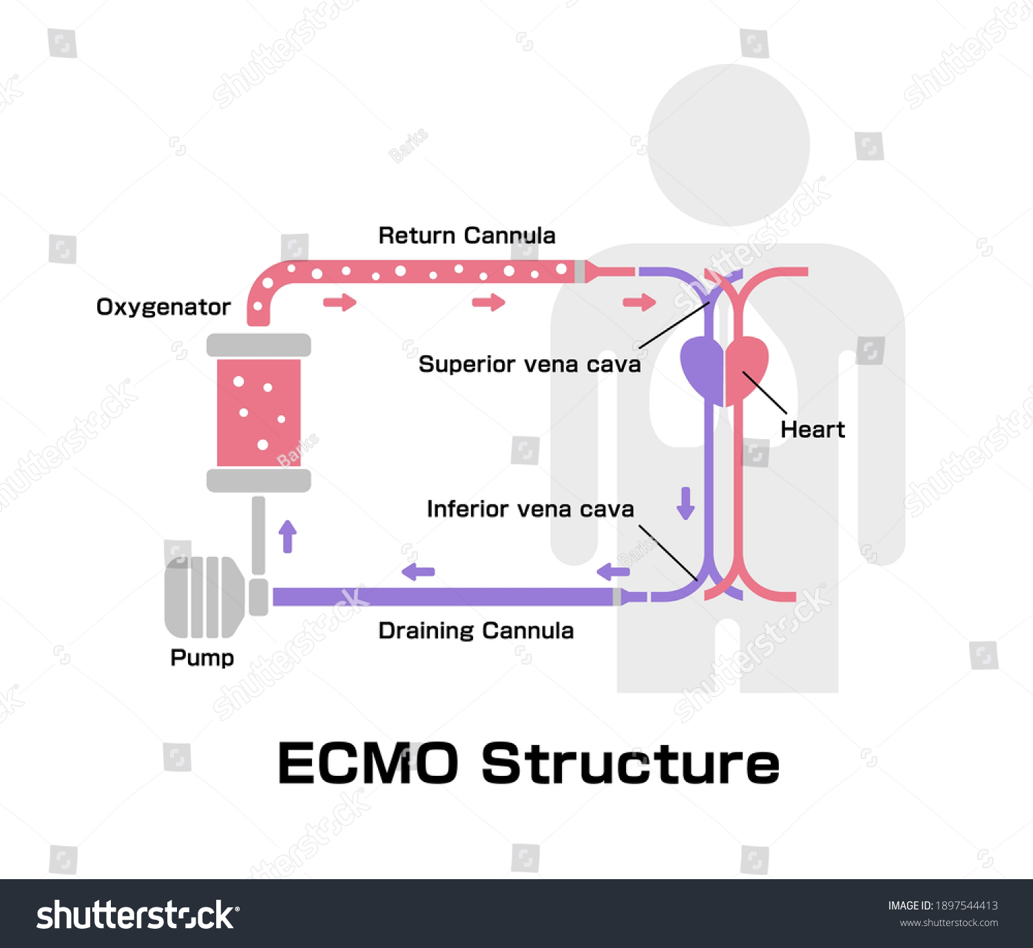 Ecmo Extracorporeal Membrane Oxygenation Structure Vector Stock Vector ...