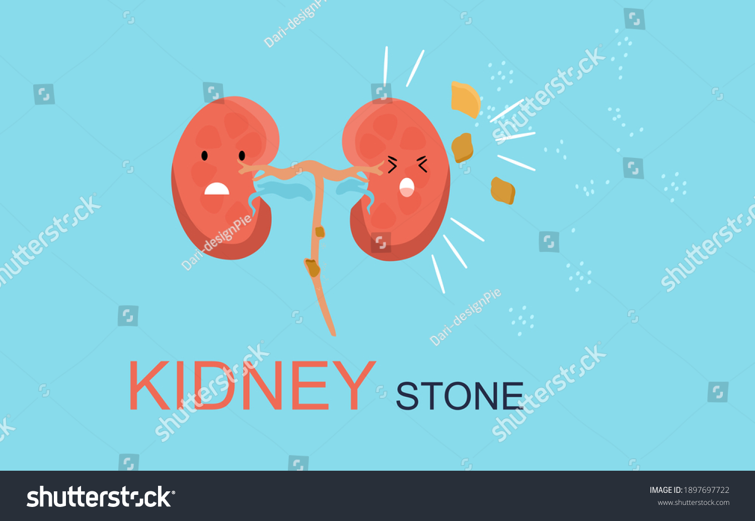 Kidney Stone Concept Cute Kawaii Human Stock Vector (Royalty Free ...