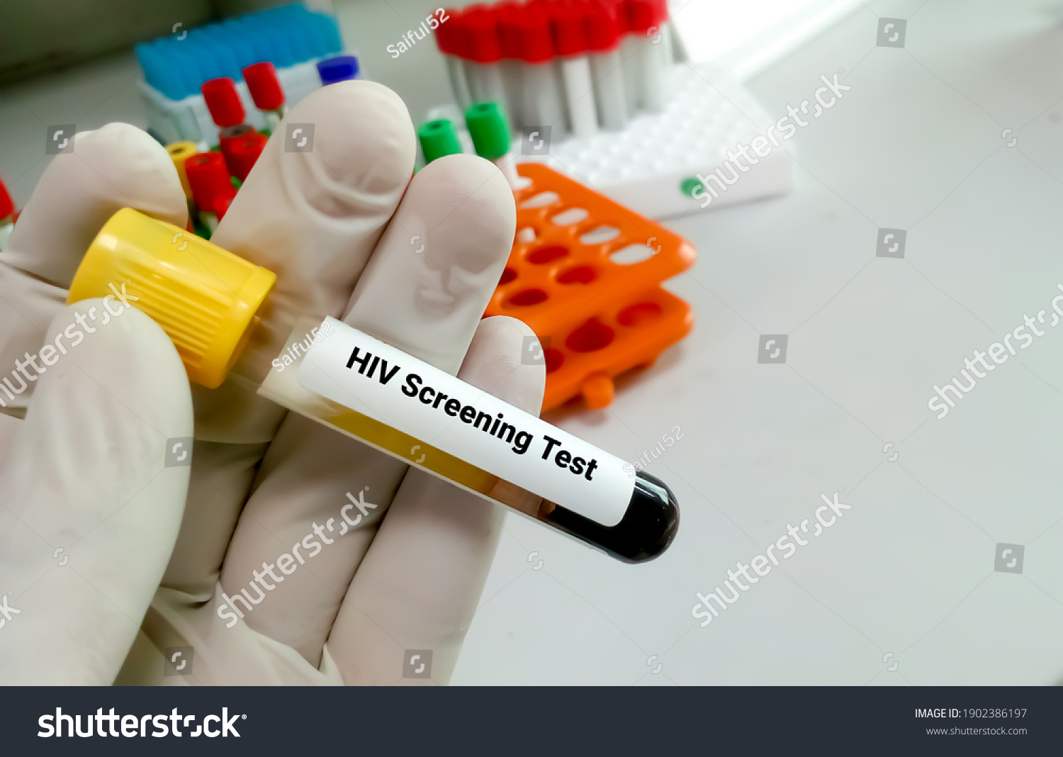 Sample Blood Collection Tube Hiv Test Stock Photo 1902386197 | Shutterstock