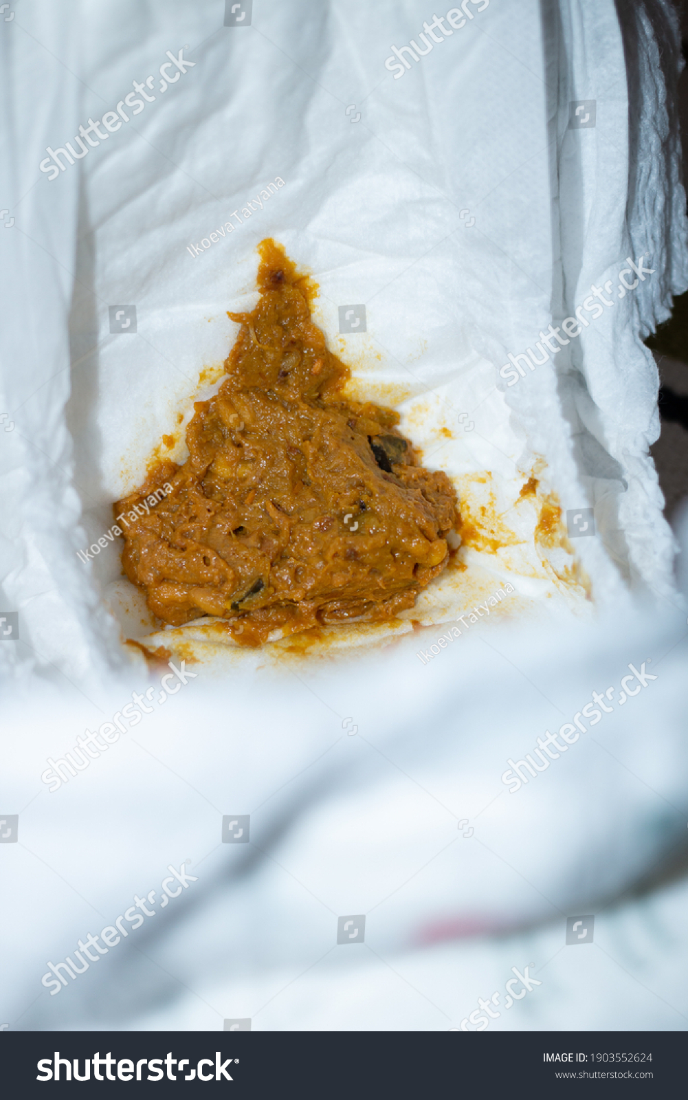 Dirty Stinky Diaper Poop Newborn Baby Stock Photo 1903552624 | Shutterstock