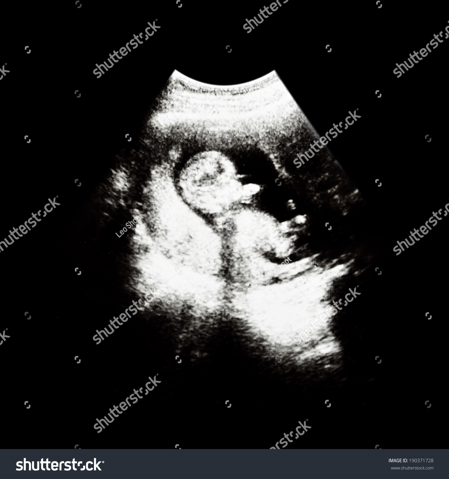 Boy Fetus 8 Month Womb Visible Stock Photo 190371728 | Shutterstock