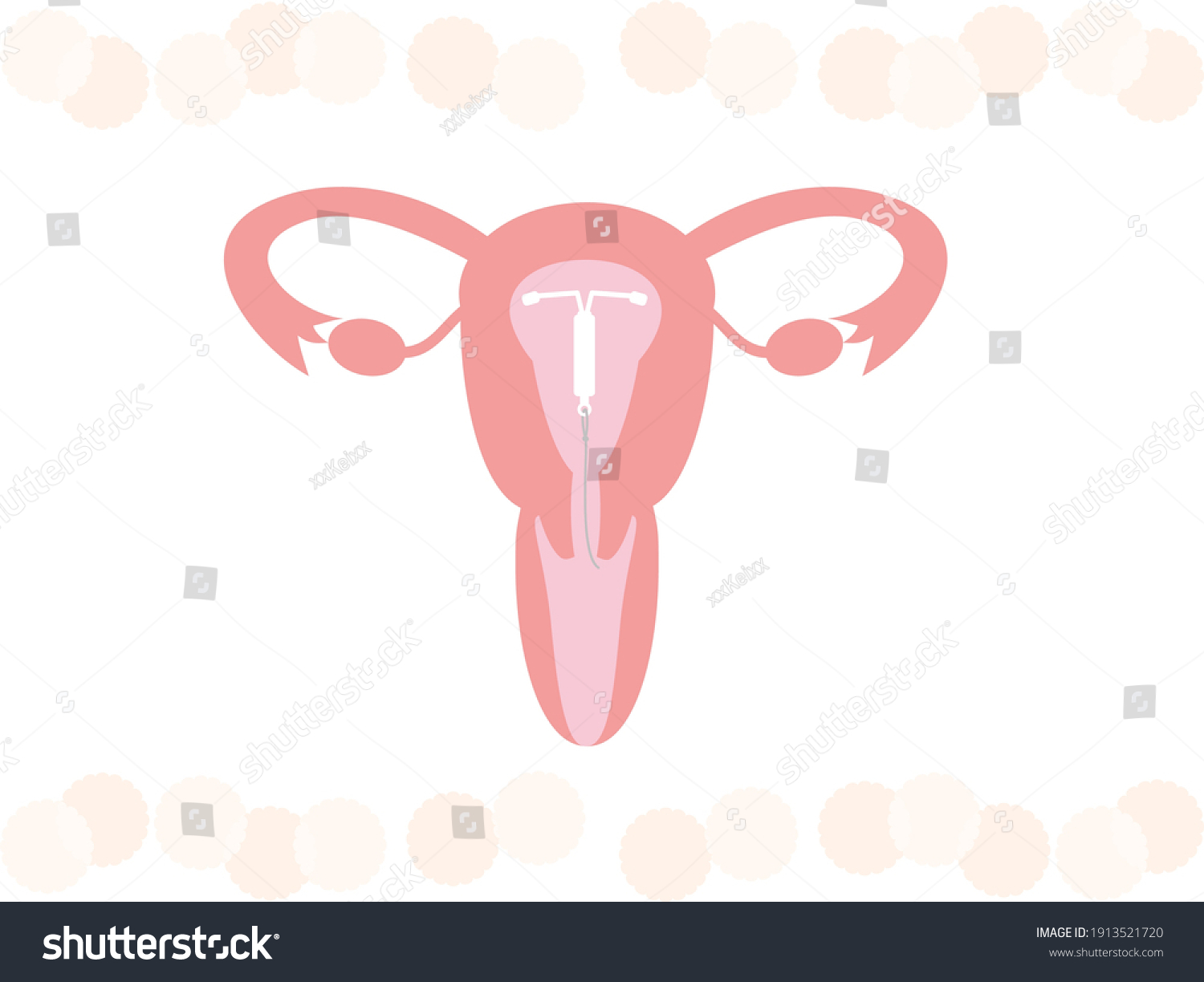 This Illustration Iud Intrauterine Device Stock Vector Royalty Free   Stock Vector This Is An Illustration Of An Iud Intrauterine Device 1913521720 