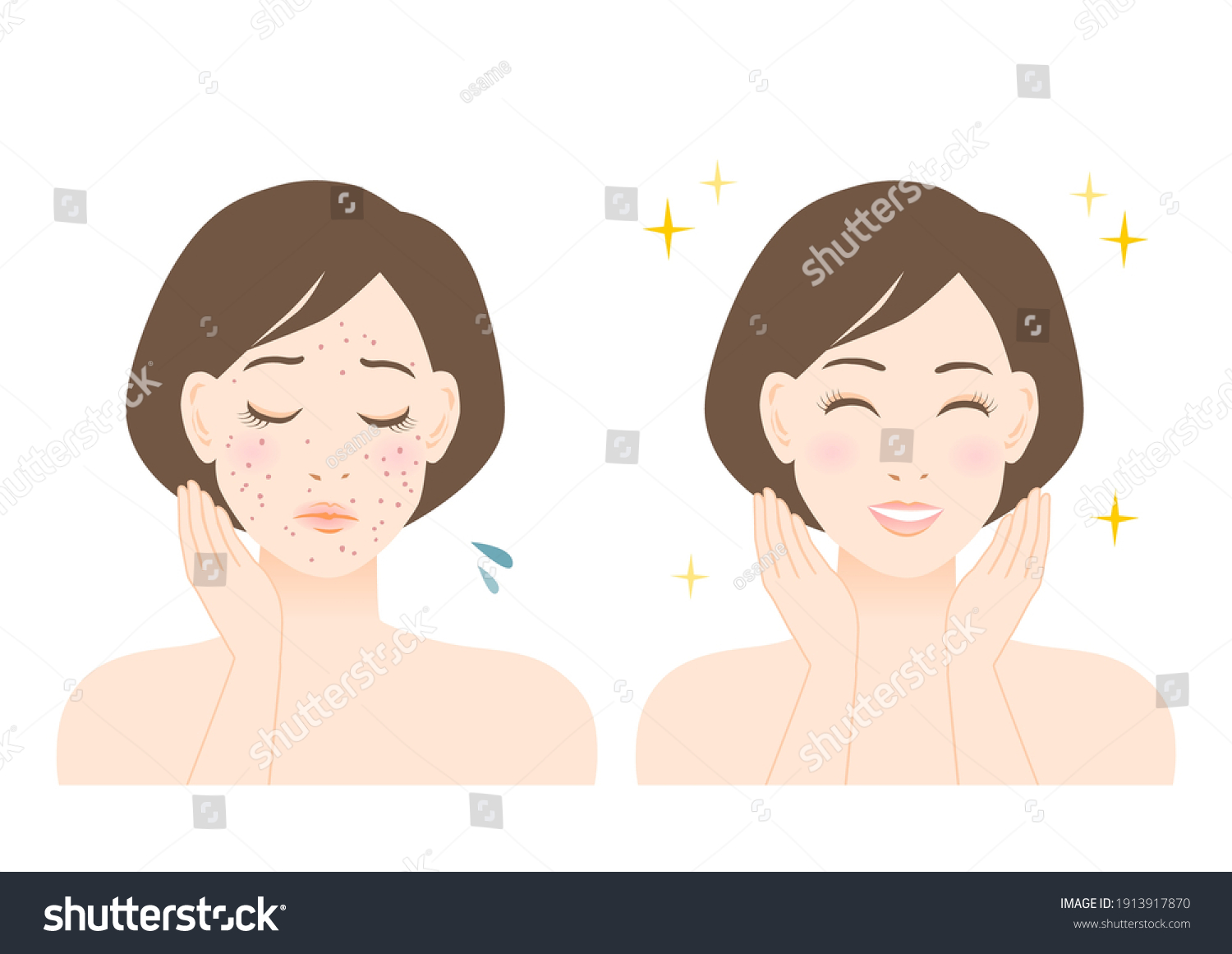 Womens Beauty Illustration Trouble Pimple Spots Stock Vector (Royalty ...