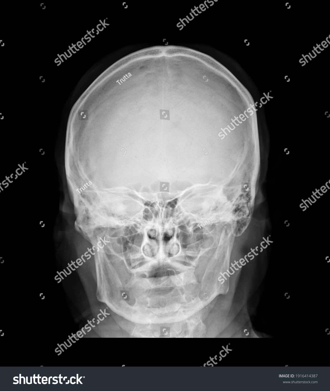 Anatomy Xray Picture Human Skull Stock Illustration 1916414387 Shutterstock