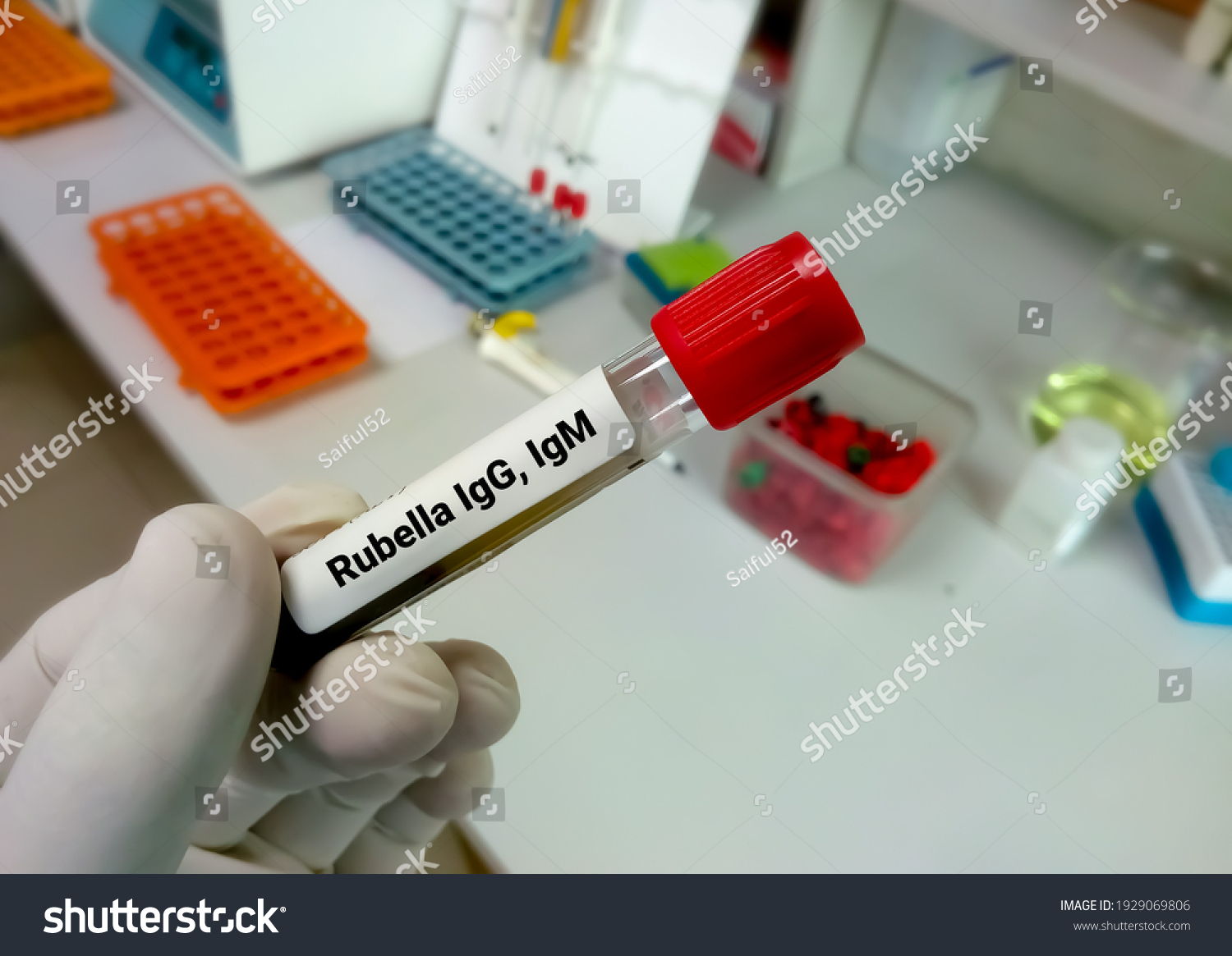 blood-sample-rubella-test-rubella-igg-stock-photo-1929069806-shutterstock