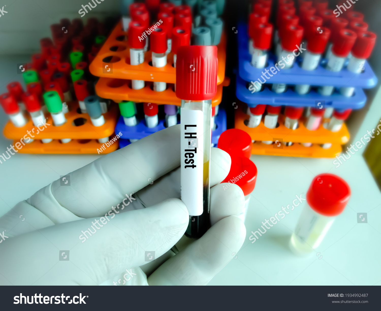 Blood Sample Tube Laboratory Background Luteinizing Stock Photo ...