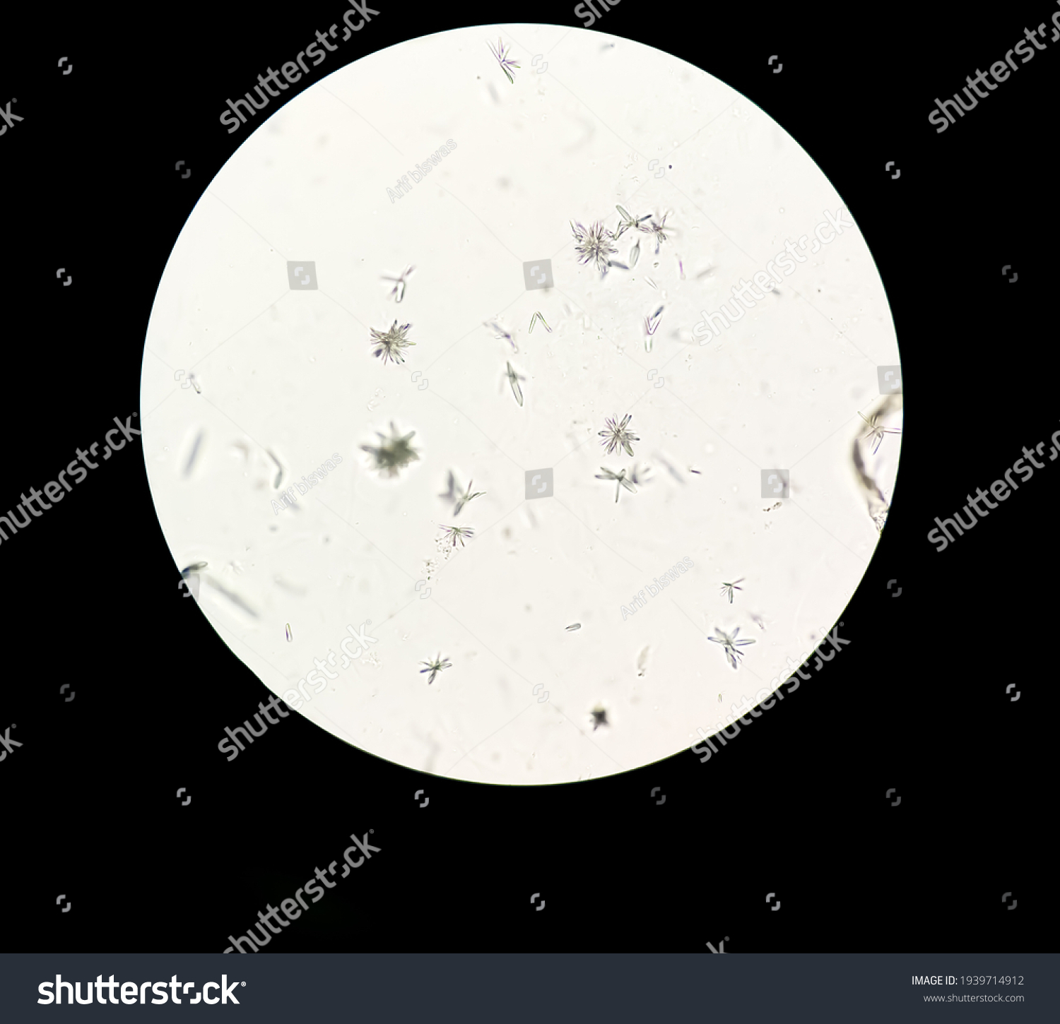 Abnormal Result Urinalysis Microscopic Method Under Stock Photo ...