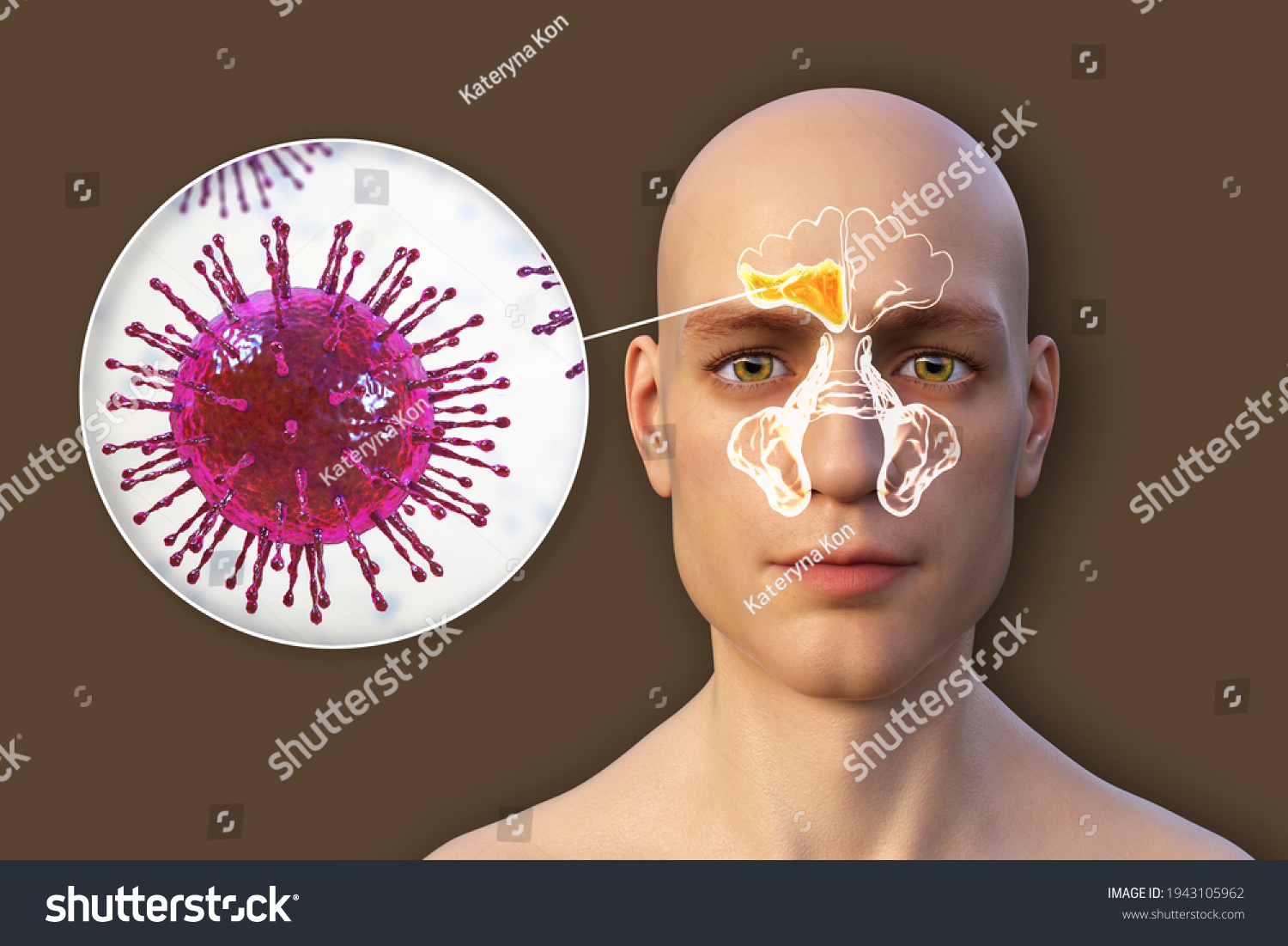 Sinusitis Inflammation Paranasal Cavities 3d Illustration Stock Illustration 1943105962