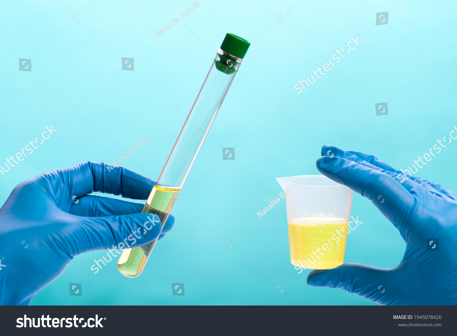 urine-analysis-laboratory-medical-urine-test-stock-photo-1945078426