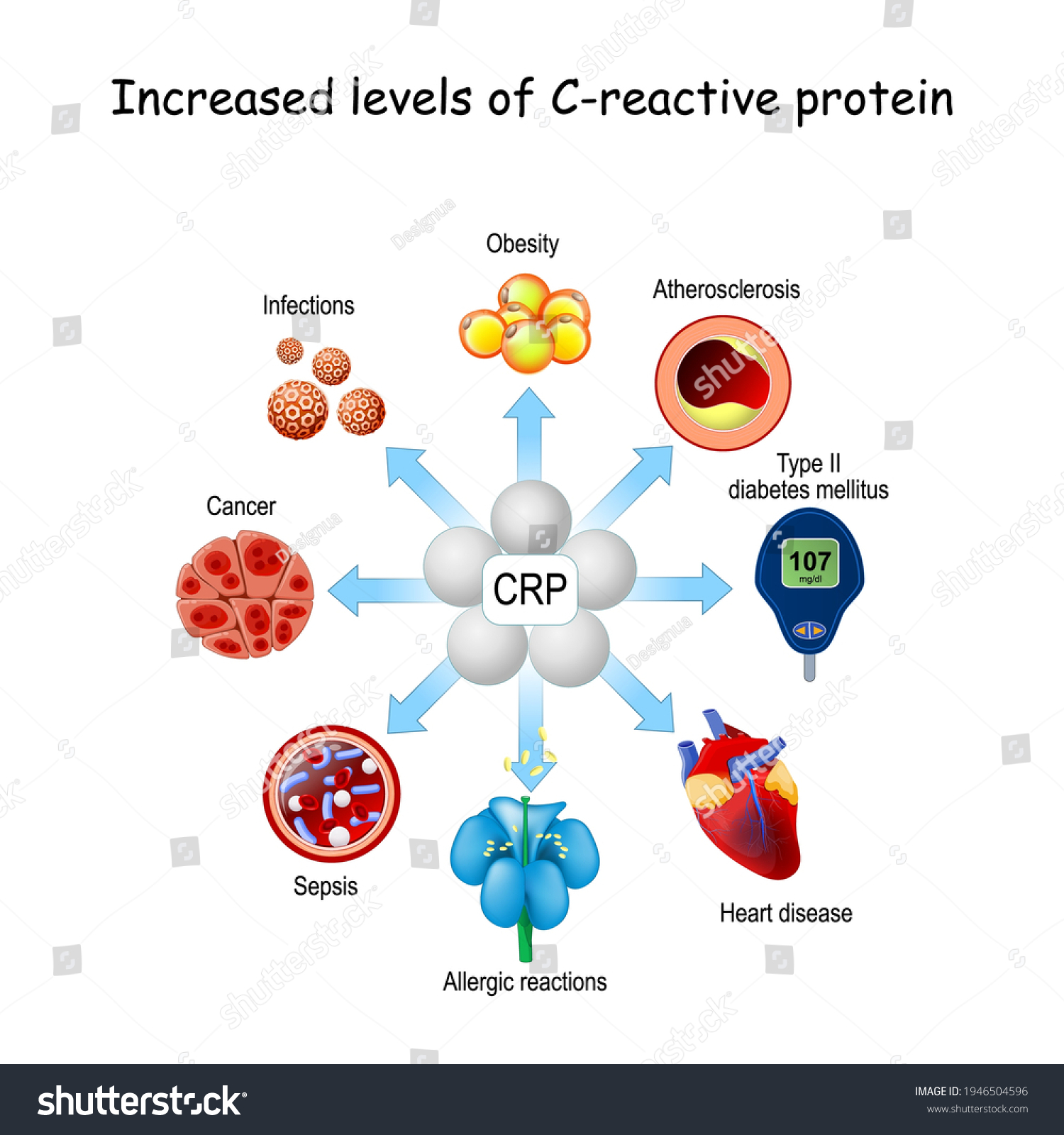 Crp это. Reactive Protein. C-реактивный белок. Среактивный белок шкала. C-Reactive Protein vector.