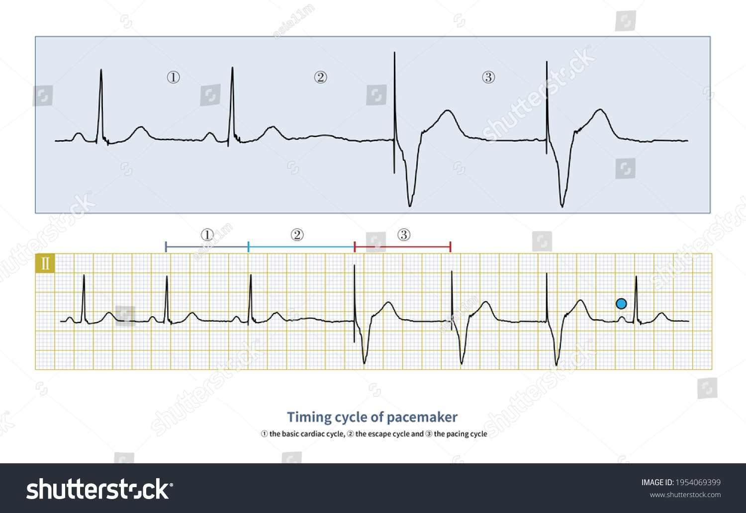 Analyze Ecg Pacemaker We Need Know Stock Illustration 1954069399 ...