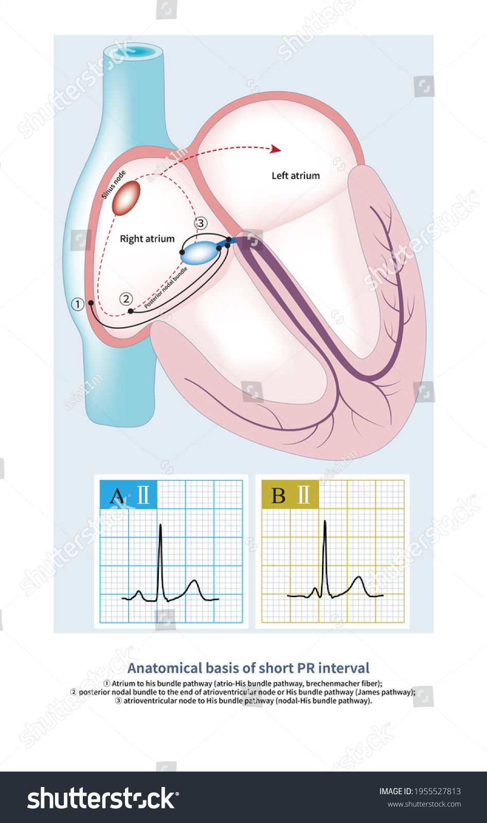 atrioventricular node