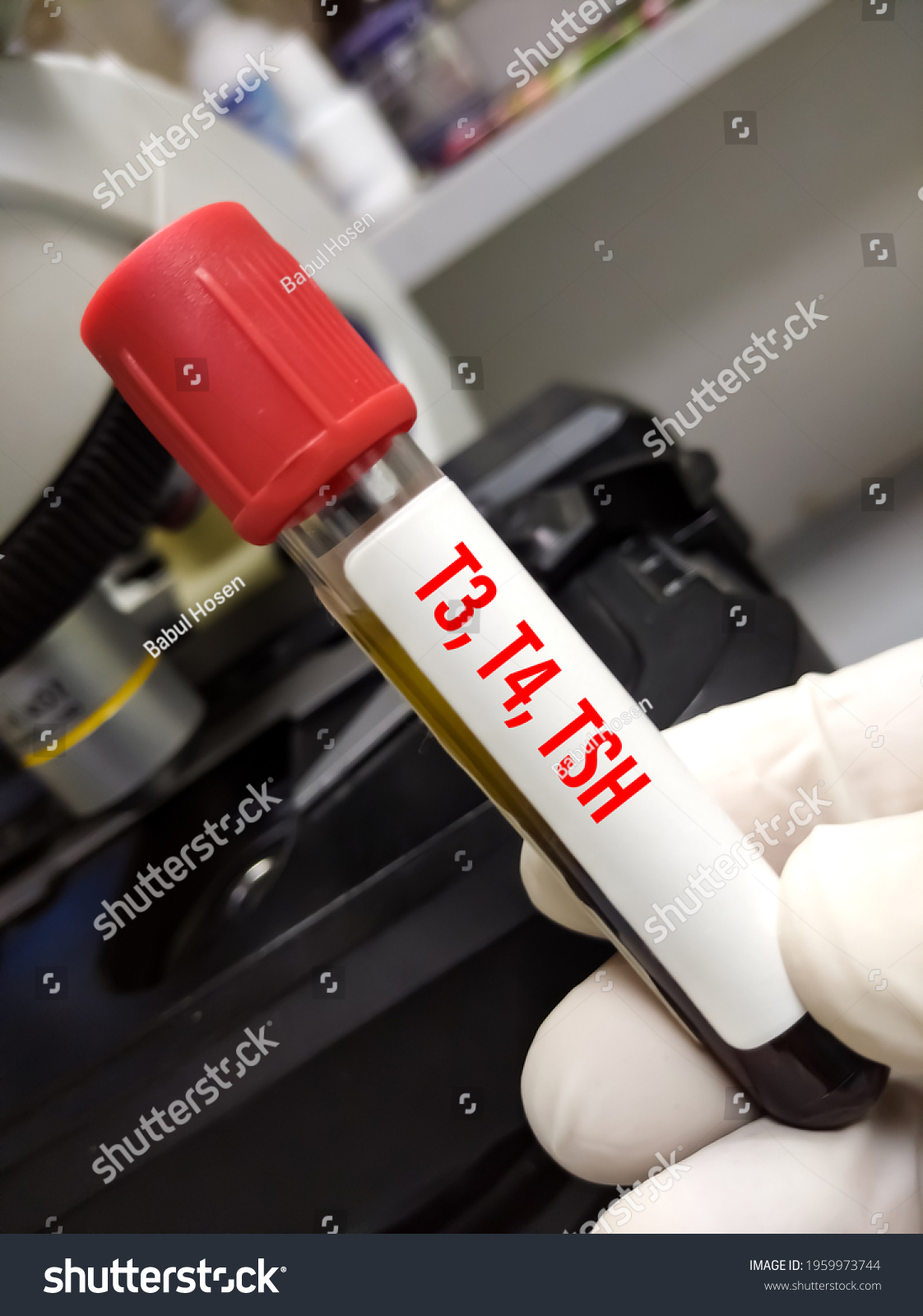 Test Tube Blood Sample Thyroid Function Stock Photo 1959973744 ...