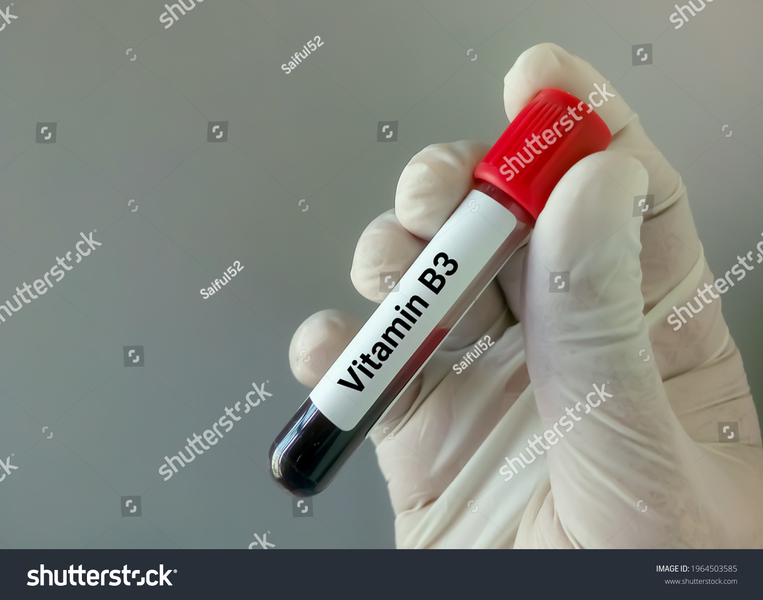 Blood Sample Vitamin B3 Test Niacin Stock Photo 1964503585 | Shutterstock