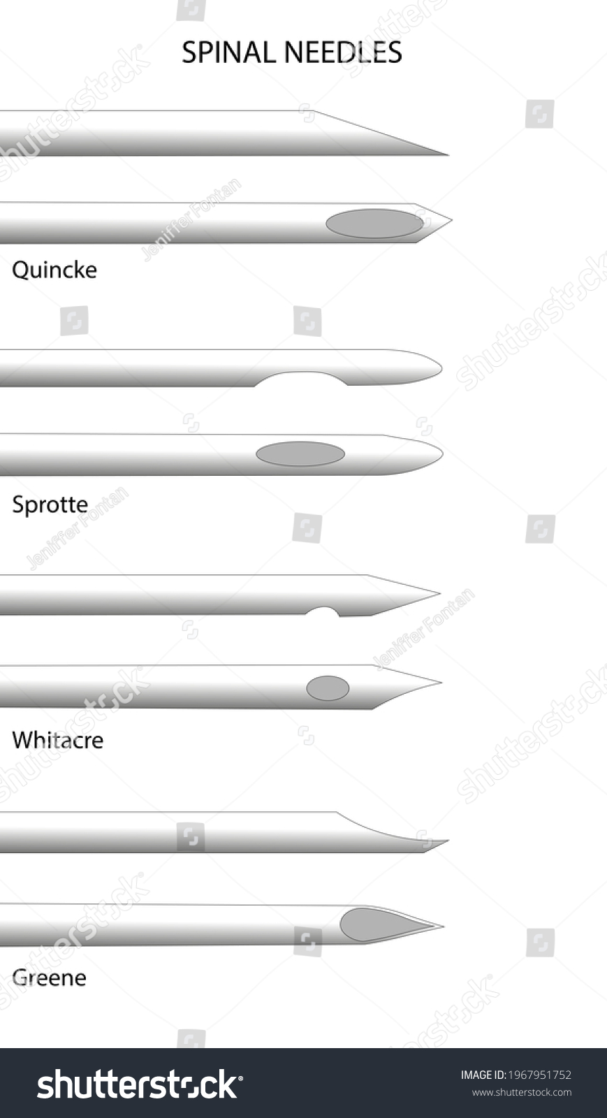 spinal-needle-different-types-spinal-needles-stock-illustration