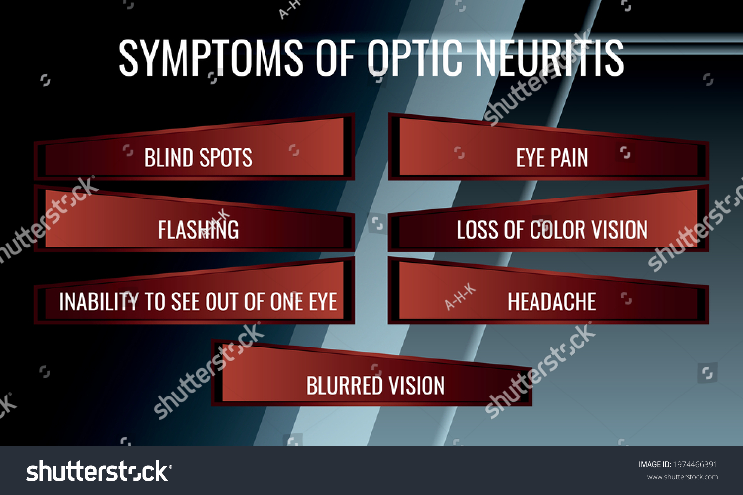 symptoms-optic-neuritis-vector-illustration-medical-stock-vector