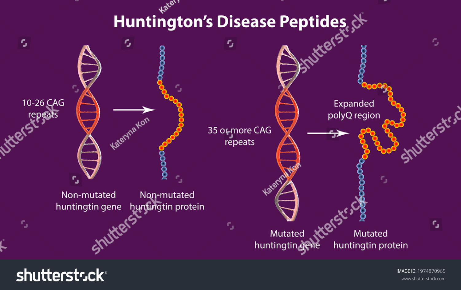 Molecular Genesis Huntingtons Disease 3d Illustration Stock ...