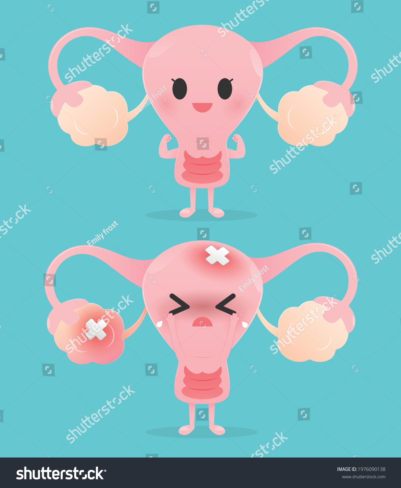 Strength Uterus Uterine Problems Miometrium Cartoon Stock Vector ...