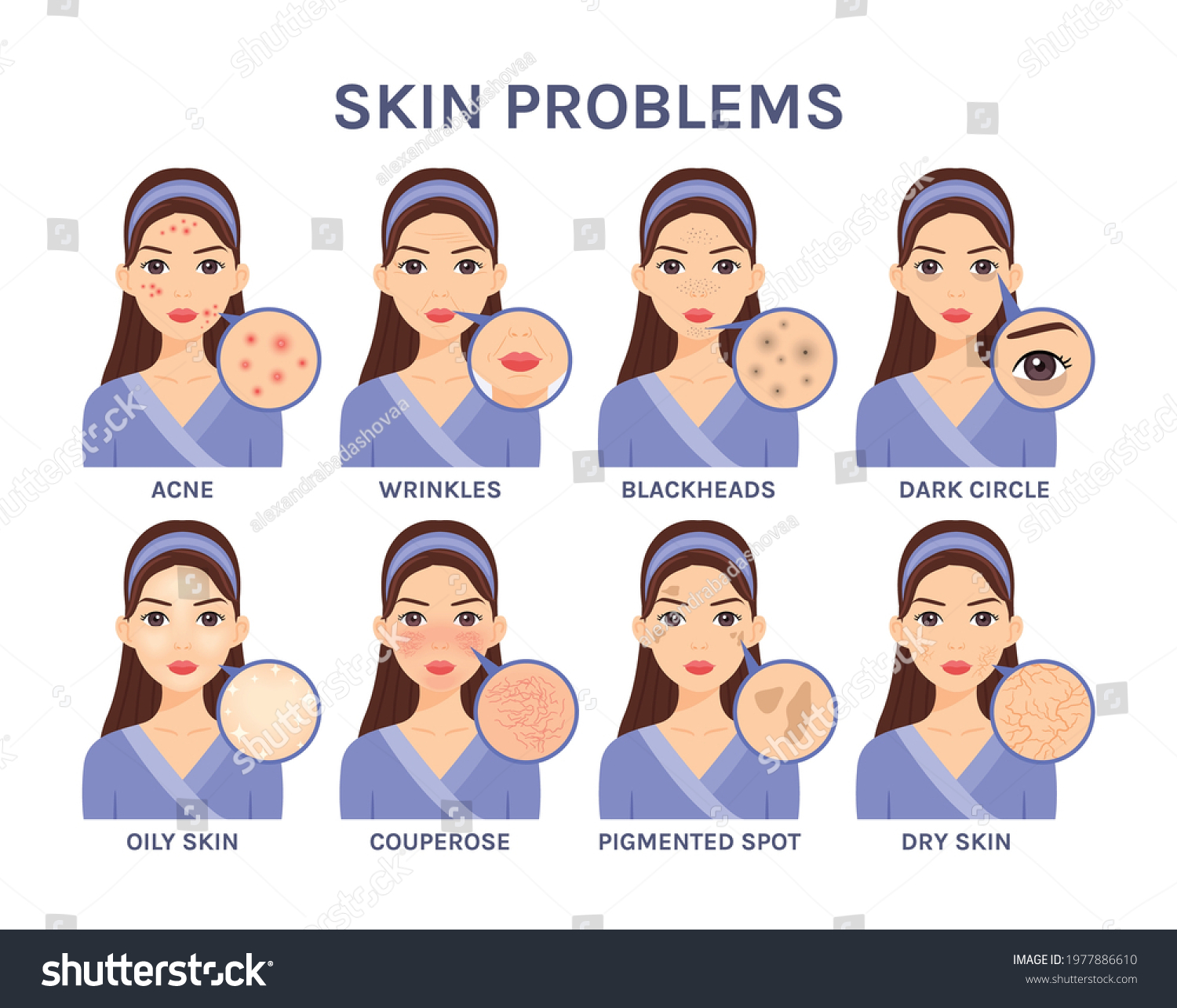 Set Beautiful Cartoon Woman Skin Problemsportrait Stock Vector (Royalty ...