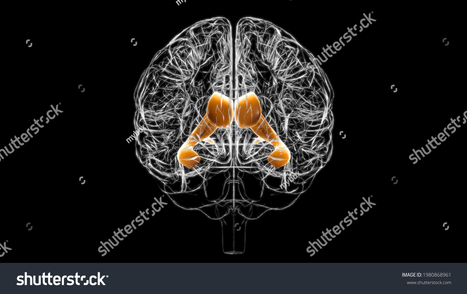 lateral ventricle of brain anatomy