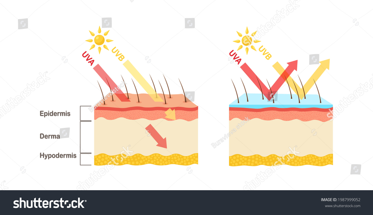 Uv Protection Sunscreen Lotion Protect Human Stock Vector (Royalty Free ...