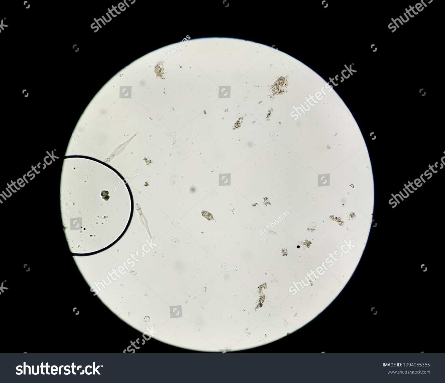 Schistosoma Haematobium Parasite Human Urine Specimen Stock Photo