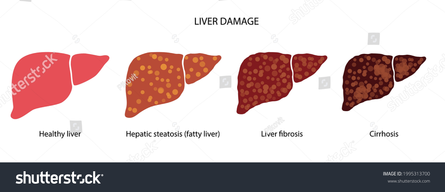 901 Fatty Cells Stock Vectors, Images & Vector Art | Shutterstock