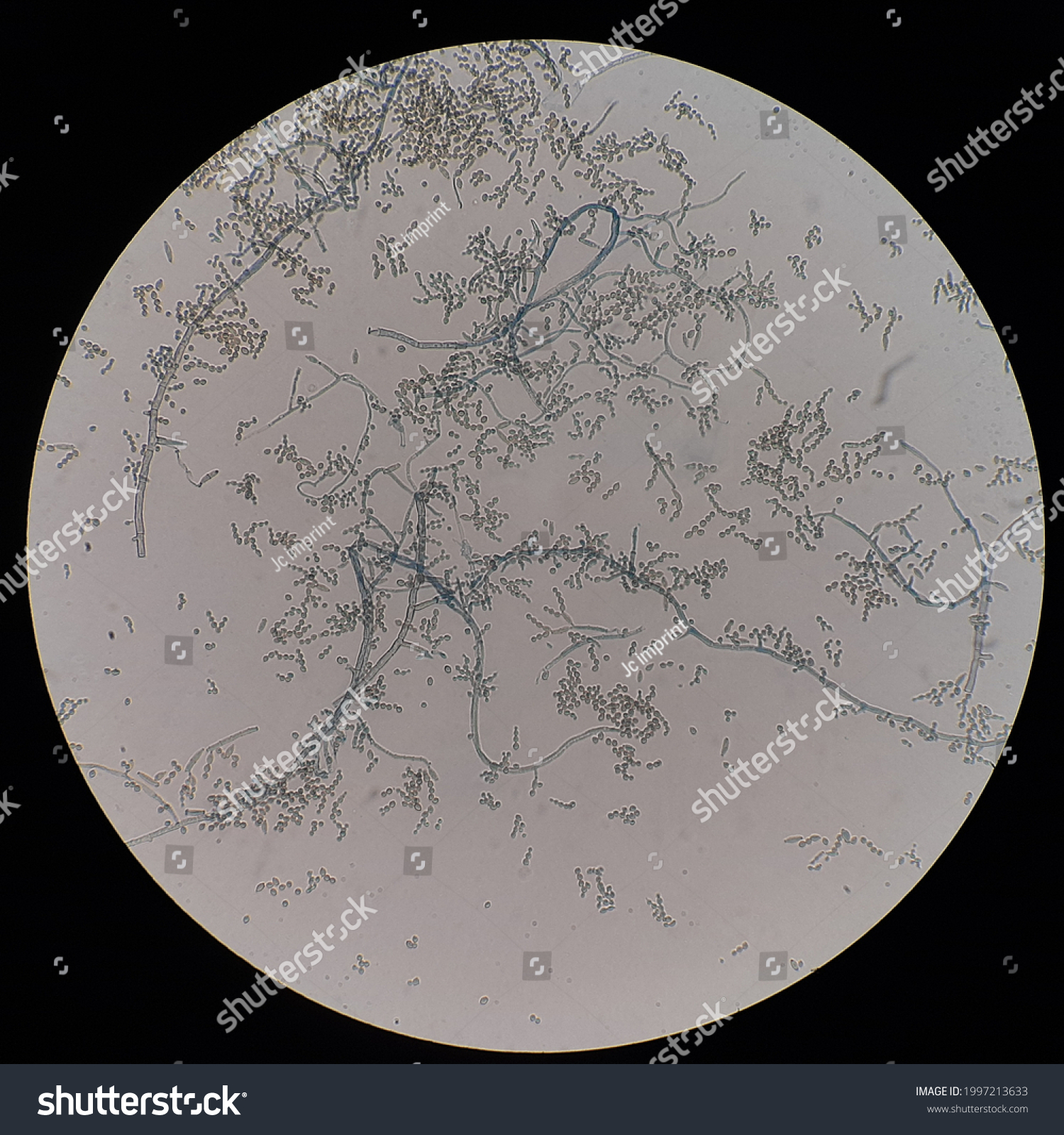 Cladosporium Sp Under Microscope Magnificient 400x Stock Photo ...