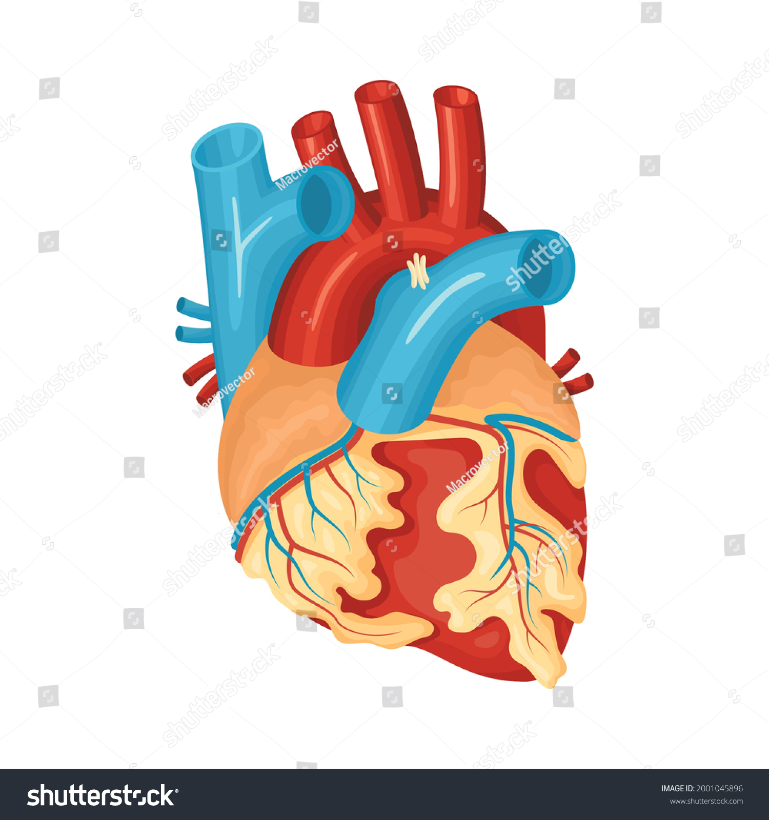 Anatomy Diseased Heart Flat Vector Illustration Stock Vector (Royalty ...