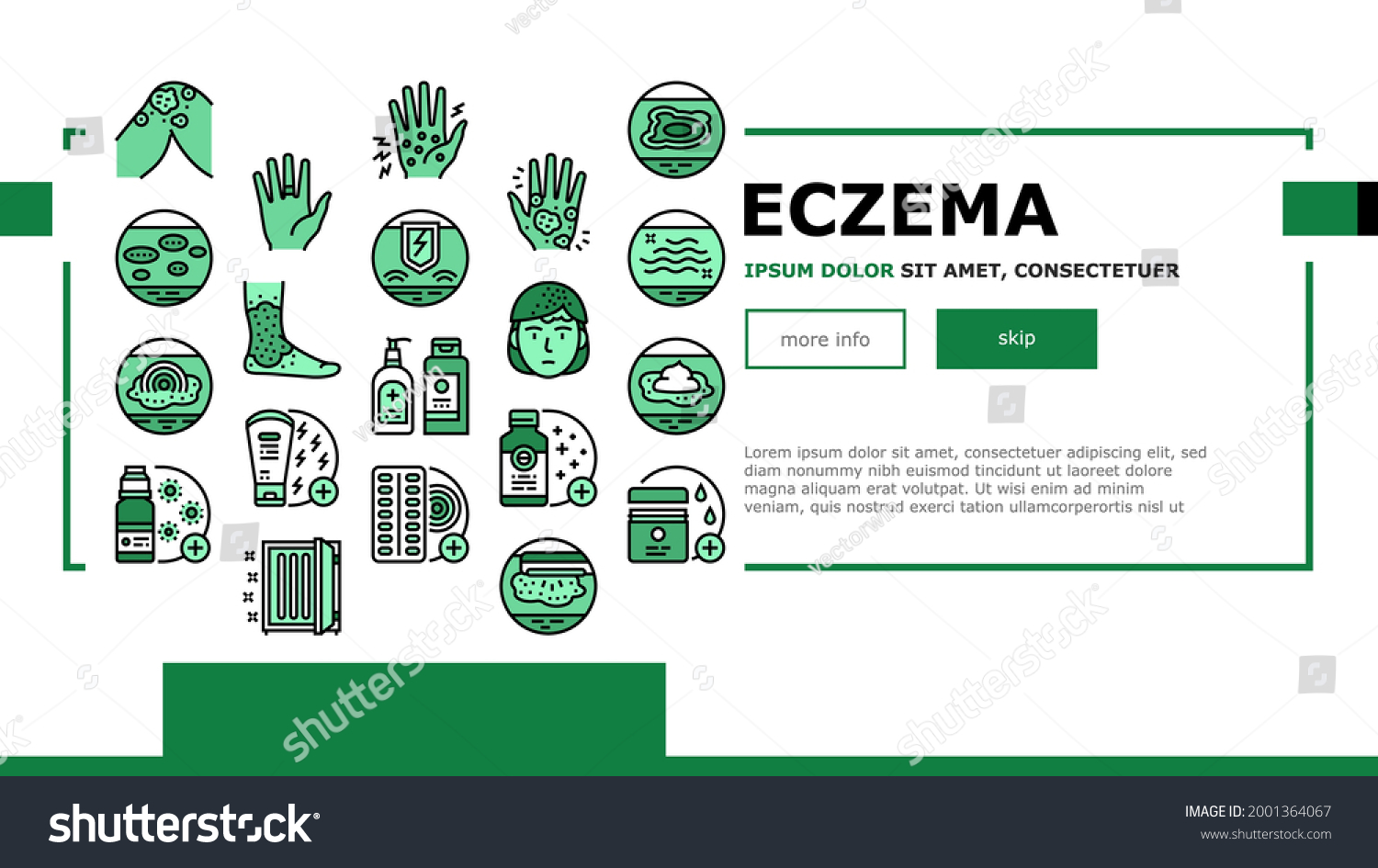 Eczema Disease Treat Landing Header Vector Stock Vector (Royalty Free ...