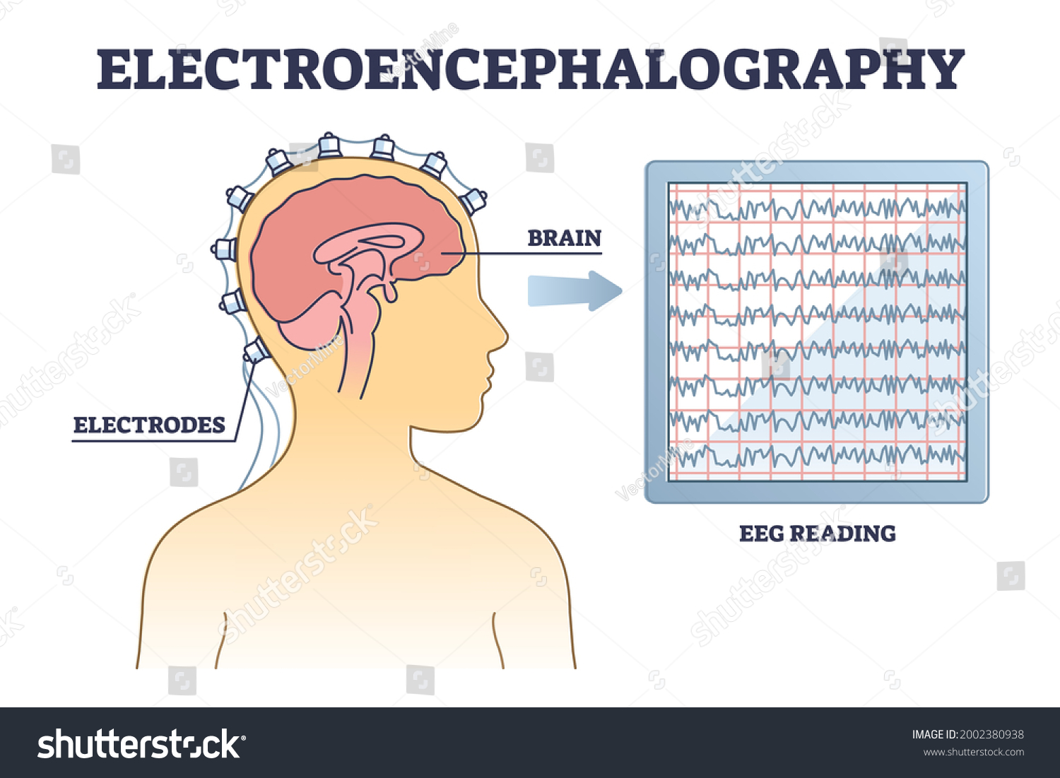 Electroencephalography Eeg Brain Activity Monitoring Outline Stock ...